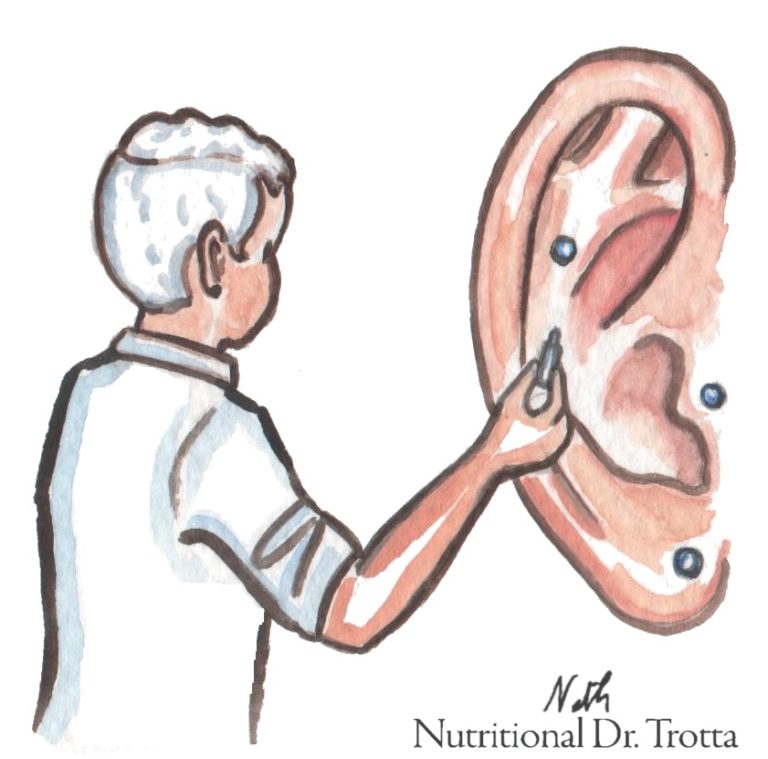 Aimants Auriculothérapie Pour Minceur – Slim Oreille – Stimulation Des Points D’acupression Pour Aider à Maigrir